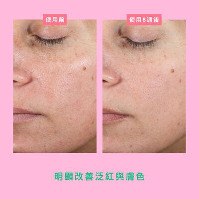 波拉深層修復霜 | Bora Barrier™ Repair Cream, 